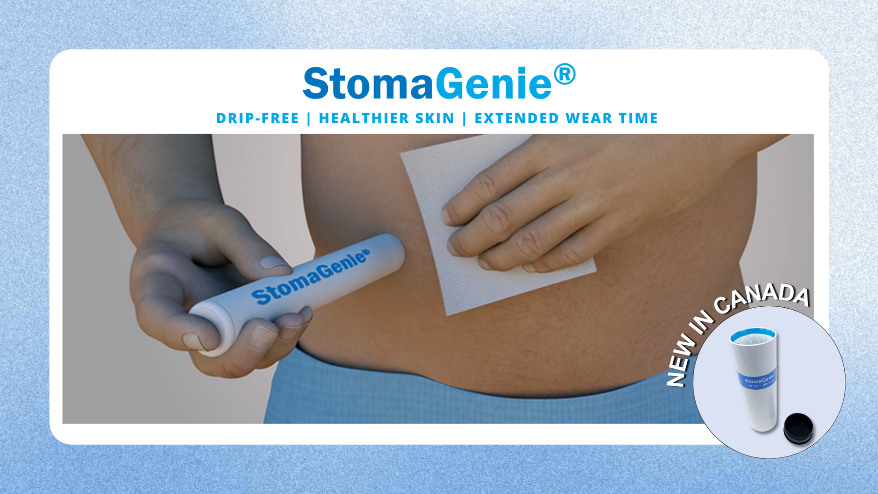 Introducing the StomaGenie: A better solution for ostomy changes